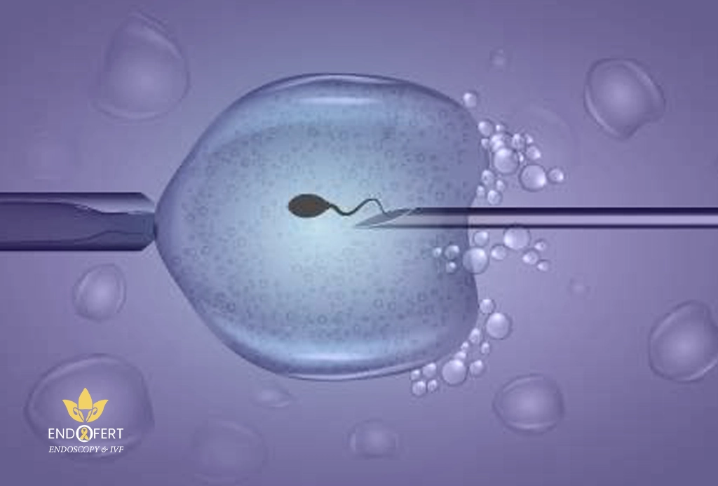 6-نقاط-تضمن-نجاح-الحقن-المجهري