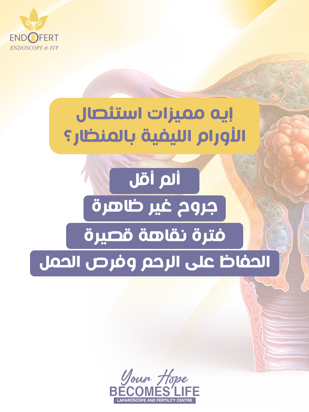 كم تستغرق عملية استئصال الورم الليفي